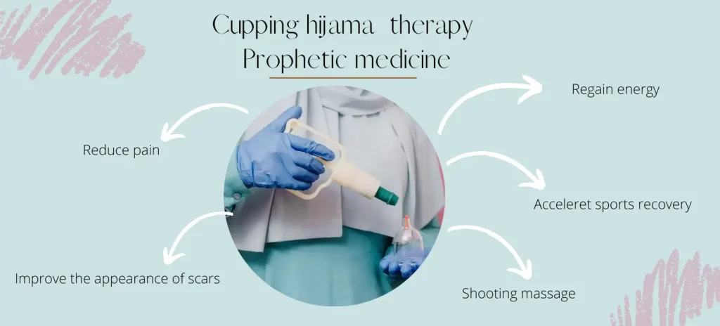 benefits hijama therapy a prophetic medicine