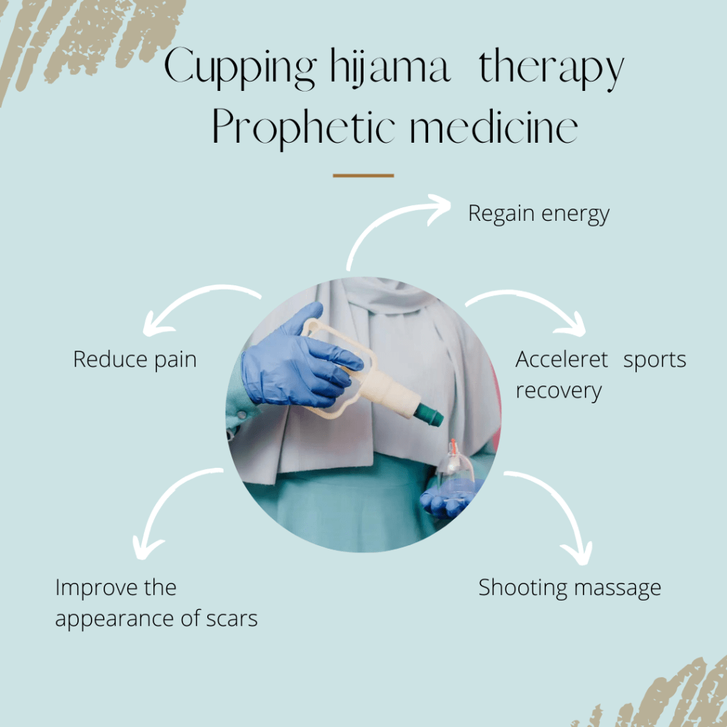 hijama benefits a prophetic medicine